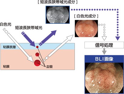 最新の内視鏡システムを導入